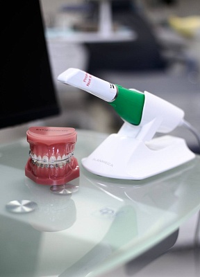 Сканирование зубного ряда